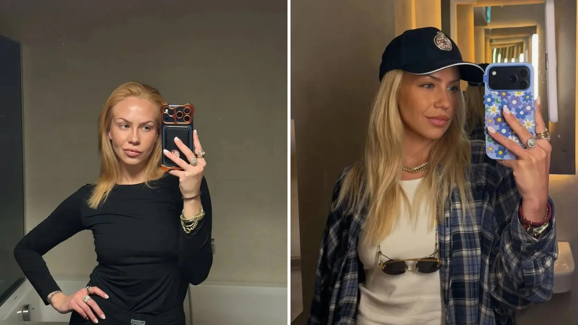 Influenserica htjela liposukciju, pa preminula nakon što je primila anesteziju