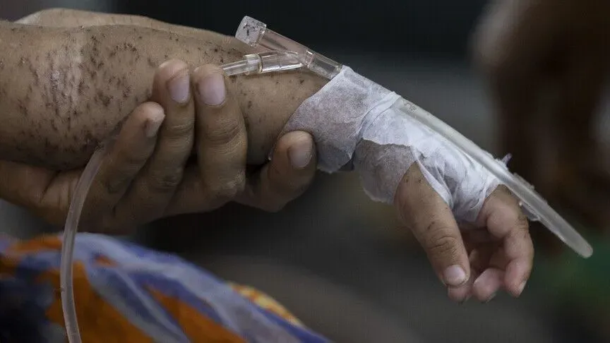 Epidemija ospica u Bangladešu odnijela više od 1.000 života, među njima djeca
