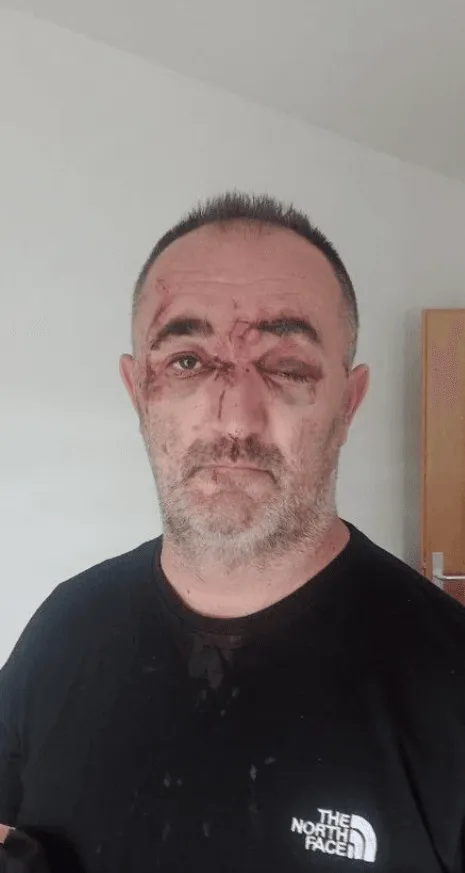 Marko Luburić, napad, Široki Brijeg, pripadnici OSBiH